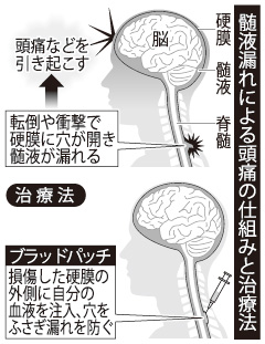 [画像]メインイメージ