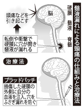 [画像]メインイメージ